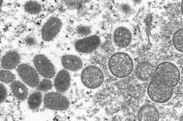 Esta imagen de microscopio de 2003 proporcionada por los CDC muestra a la viruela del mono. 