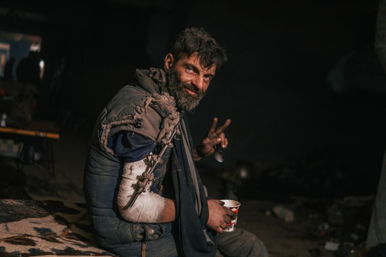 A wounded soldier holds up a peace sign and smiles despite his injuries.