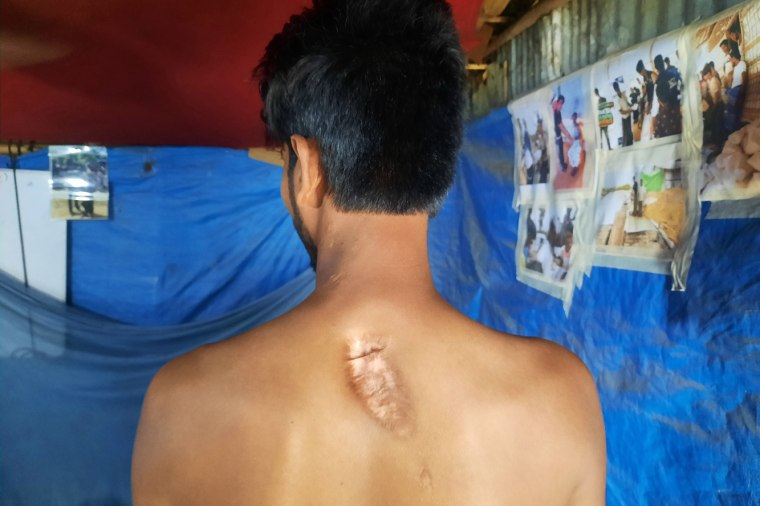 Shaiful, 22, says the Myanmar military shot him in the back in 2017.