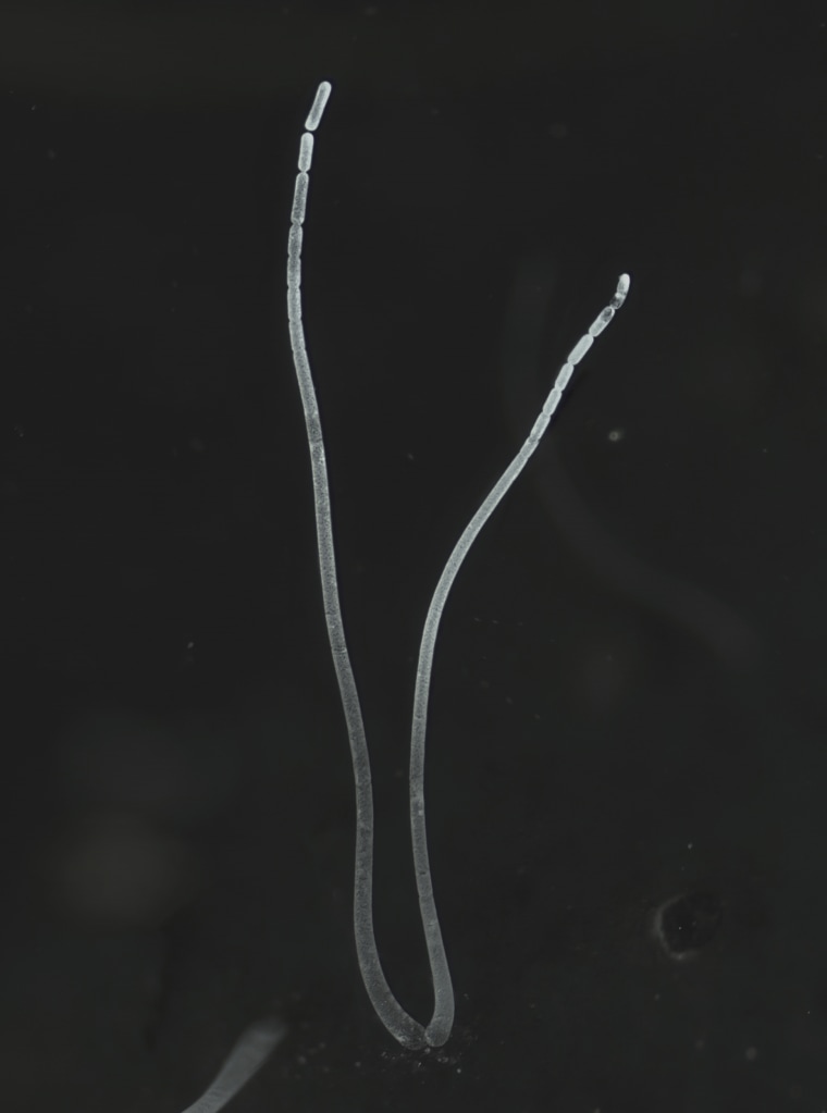 Filaments of a Thiomargarita magnifica bacteria cell.