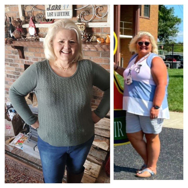 After losing 50 pounds by walking 1 woman avoids knee replacement