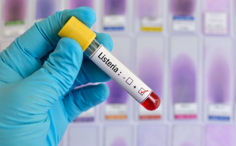 Una muestra de sangre con un resultado de laboratorio positivo a la bacteria listeria.