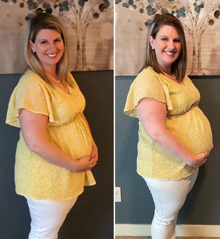 Kellee Briggs compared how she looked at 20 weeks with one baby vs. three.