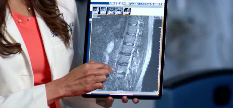 Dr. Kiran Patel shows the important MRI that helped show what was causing Carson Daly's back pain that had been present for 25 years.