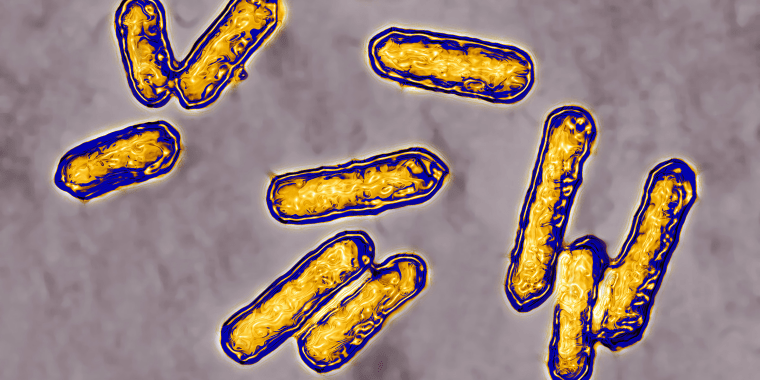 The CDC is actively investigating a listeria outbreak.