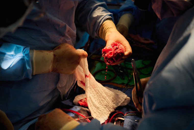 Surgeons prepare a genetically modified pig heart for xenotransplantation at NYU Langone Health on Wednesday, July 6, 2022, in New York.