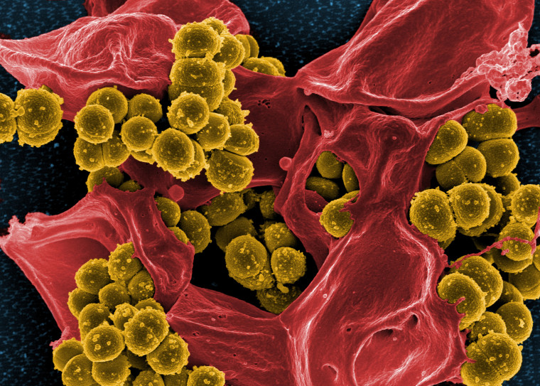 Micrograph of methicillin-resistant staphylococcus aureus (mrsa)