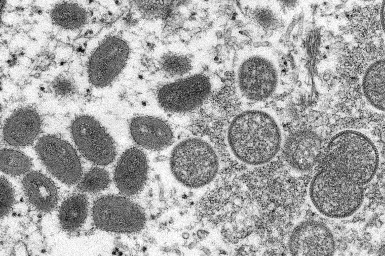This 2003 electron microscope image made available by the U.S. Centers for Disease Control and Prevention shows mature, oval-shaped monkeypox virions, left, and spherical immature virions, right, obtained from a sample of human skin associated with the 2003 prairie dog outbreak.