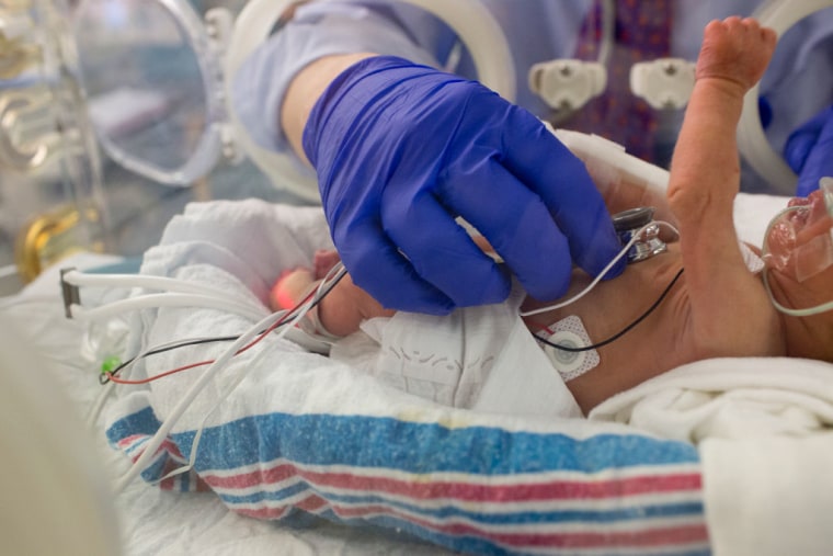 Un médico revisa a un bebé nacido prematuramente el 15 de septiembre de 2016 en la ciudad de Nueva York.