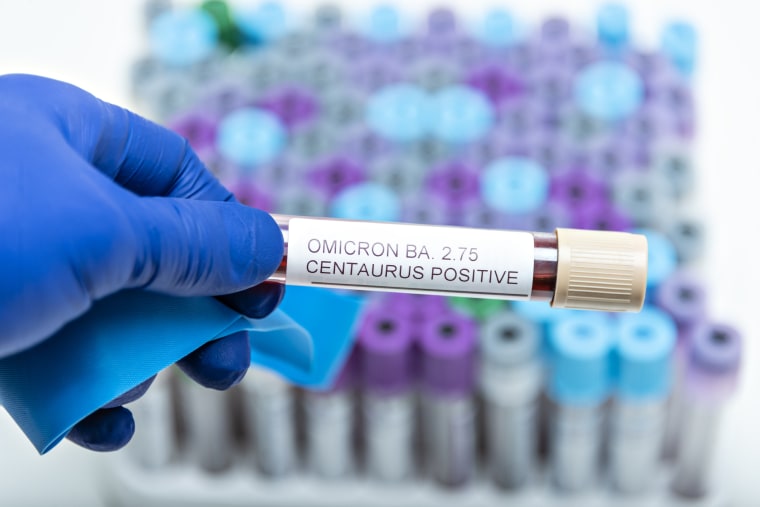 Muestra de sangre positiva para la subvariante BA 2.75 de ómicron. Foto tomada en un laboratorio de España.