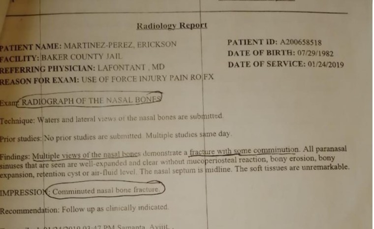 Informe médico de Eric Martinez, donde se reporta la fractura de su nariz, elaborado en el centro Baker, Florida.