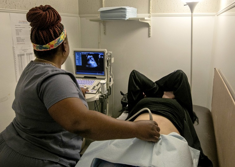 Una técnica de quirófano realiza una ecografía a una paciente en Hope Medical Group for Women en Shreveport, Luisiana, el 6 de julio de 2022.