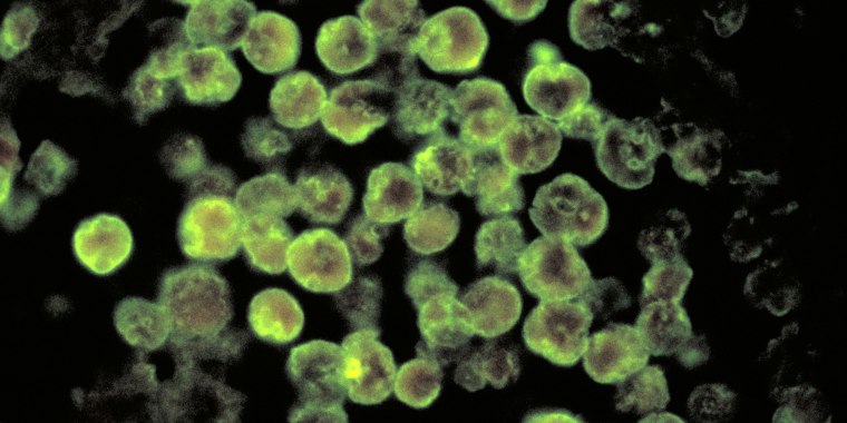 Naegleria fowleri, commonly referred to as the “brain-eating amoeba,” is a single-cell organism found in warm bodies of freshwater