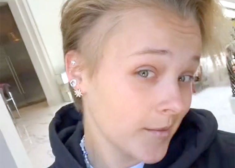 JoJo Siwa shows fans 'bald spot,' hair loss due to stress of 'Dance Moms'