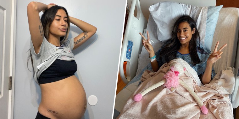 Raquel Rodriguez had a 10.5-pound cyst on her ovary that caused her to look pregnant.