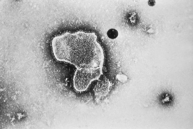 Image: A highly-magnified transmission electron microscopic image of the human respiratory syncytial virus (RSV).