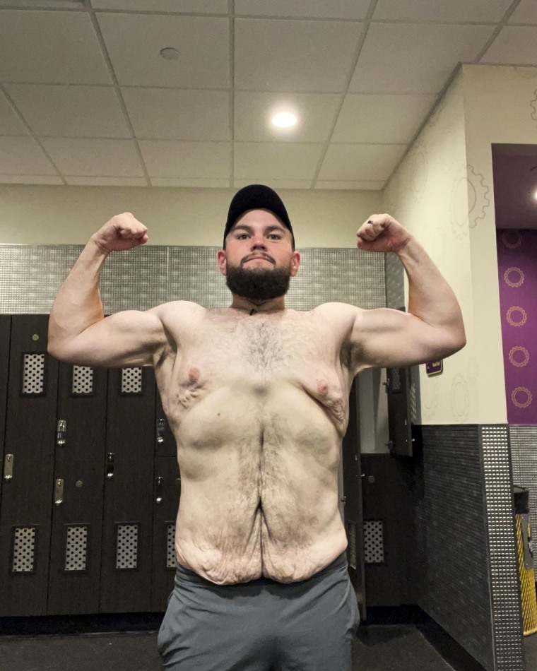 Image: Doctors told Jacob Stevens he wouldn't make it to middle age if he didn't lose weight. Now, after losing 200+ pounds, he's taking part in runs and bodybuilding competitions.