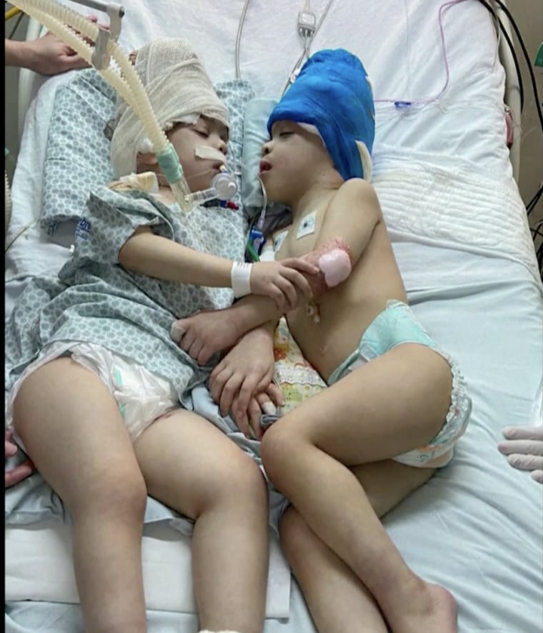 Image: Twins Arthur and Bernardo Lima sleep next to each other after a successful separation surgery in Rio de Janiero.