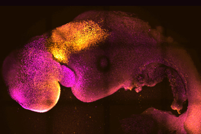 This microscope image shows a synthetic mouse embryo with colors added to show the formation of the brain and heart.