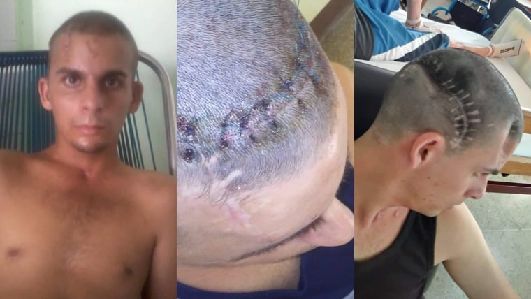 Rancel Areces, de 23 años, sufrió un accidente durante el servicio militar en Cuba y hoy sufre de una parálisis parcial. Su caso no fue reportado por las autoridades cubanas. 