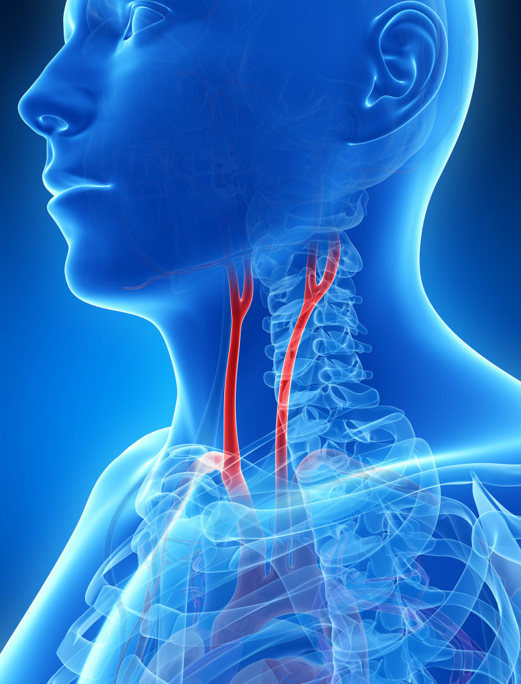 3d,Rendered,Illustration,Of,The,Carotid,Artery