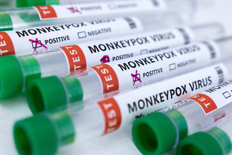 Tubos de exámenes positivos y negativos de la viruela del mono.