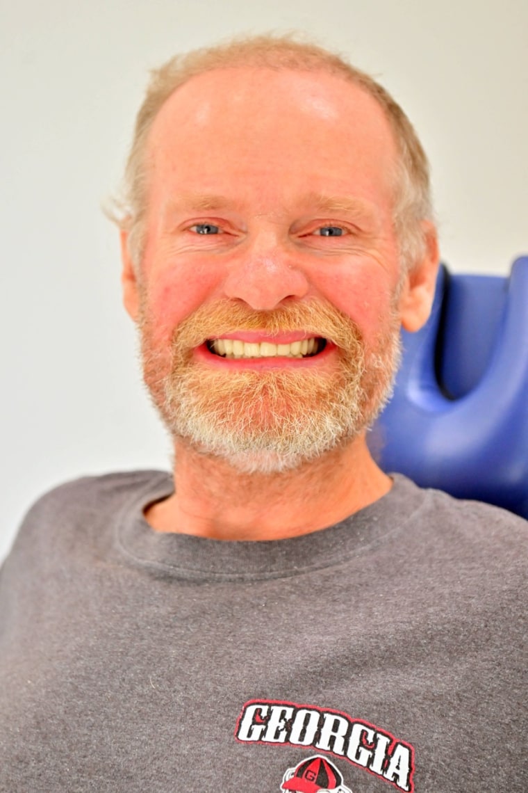 Mike "Sugar Bear" Thompson smiles while wearing his new snap-in dentures.