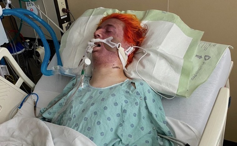 Image: Holden White in the hospital shortly after his attack.