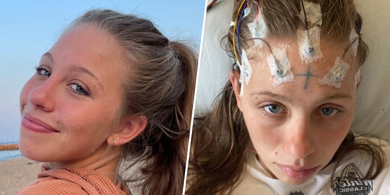 Grace Hinchman before her sudden illness, left, and during her hospital stay this summer. "This came out of nowhere," she said. "It was very weird and scary."   