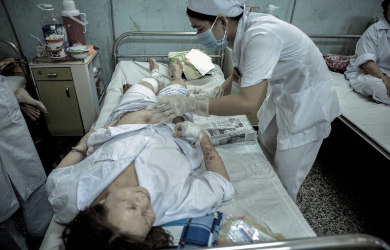 A nurse changes the dressings of a cancer patient in Can Tho, Vietnam.