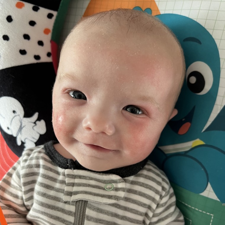 Owen could be the first of many children born with heart defects who receive the life-saving procedure.