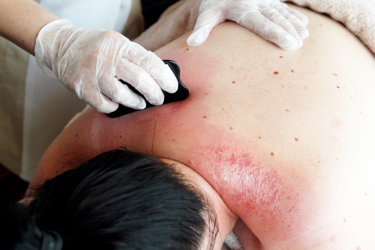 Dr Gladys Leung, Traditional Chinese Medicine Consultant of Chuan Spa administering the "Gua sha" at Chuan Spa, Langham Place in Mong Kok.13SEP12