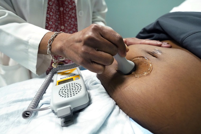 Dr. Felecia Brown, a midwife at Sisters in Birth, a Jackson, Miss., clinic that serves pregnant women, left, uses a hand-held Doppler probe on Kamiko Farris, of Yazoo City, to measure the heartbeat of the fetus, Dec. 17, 2021.