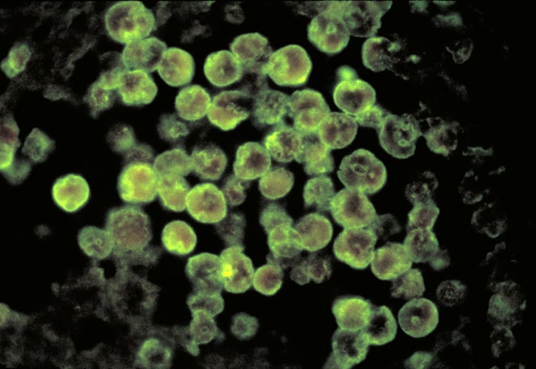 Naegleria fowleri, also known as a brain-eating amoeba, taken through a microscope.