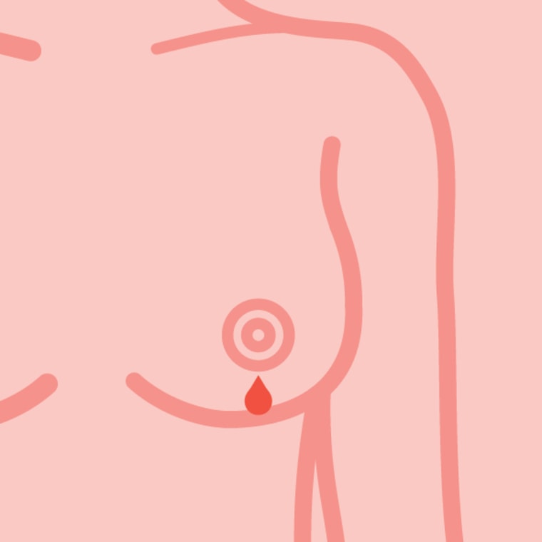 Breast Cancer Scare: How One Lump Made Me Appreciate My Saggy Boobs