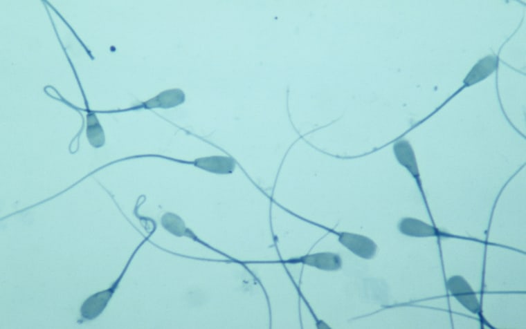 Espermatozoides, amplificados 250 veces en un microscopio.