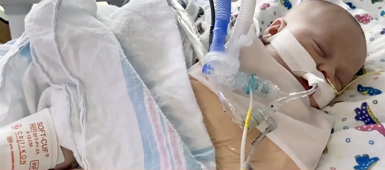 El hijo de 7 semanas de Cory Robertson necesitaba un ventilador debido a su infección por RSV.