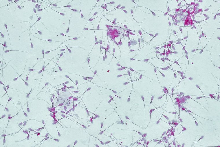 Sperm cells under a microscope.