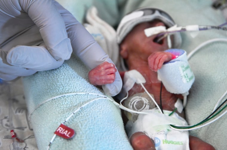 Premature Births At An All time High In The U S March Of Dimes Report 