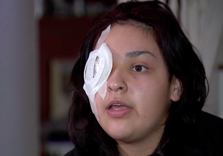 Bianca Palomera, de 19 años, fue agredida cuando intentó defender a un niño que estaba siendo acosado por un hombre. 