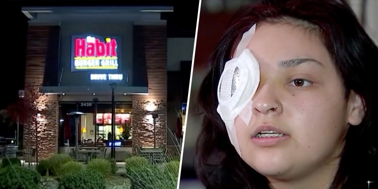 fast-food-worker-loses-eye-protecting-special-needs-boy