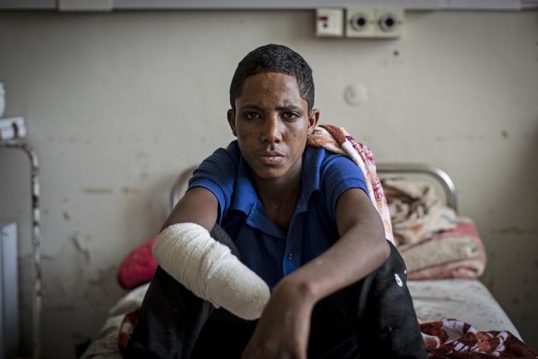 Haftom Gebretsadik, a 17-year-old from Freweini, Ethiopia, sits on his bed at the Ayder Referral Hospital in Mekele, in the Tigray region of northern Ethiopia, on May 6, 2021. He had his right hand amputated and lost fingers on his left after an artillery round struck his home in March,