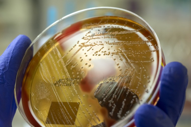 A microbiologist holding a blood agar plate showing the beta-hemolysis caused by pathogenic bacteria Streptococcus pyogenes. 