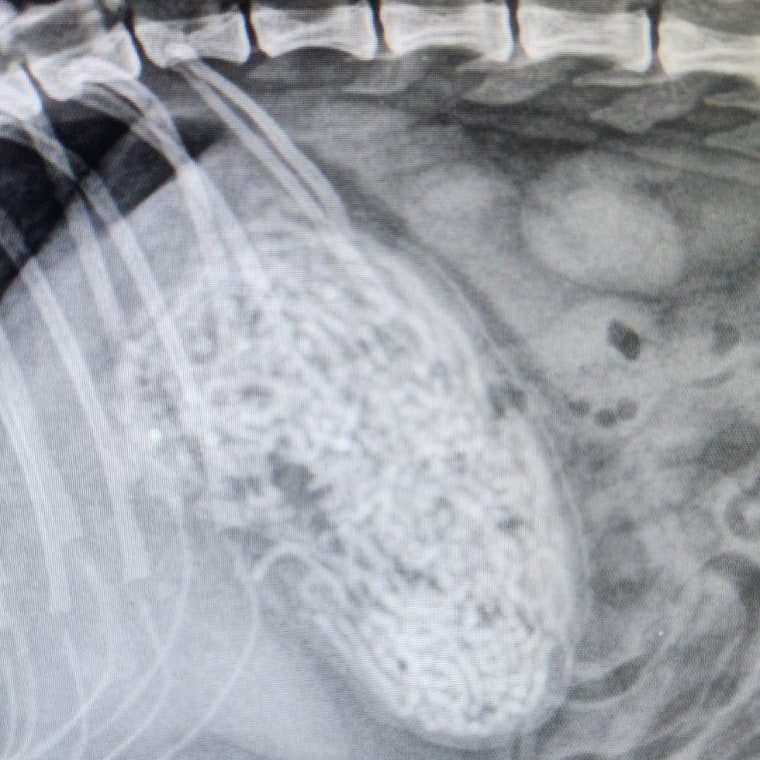 The radiograph showing the mass of hair ties in Juliet's stomach.