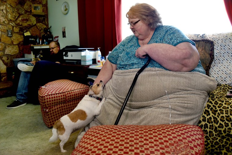Weight Loss Surgery Saves Life Of Woman Who Weighed 900 Pounds