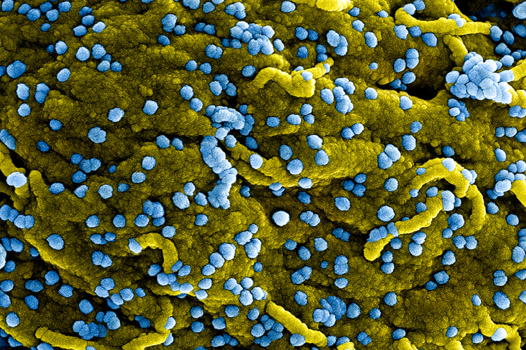 Colorized scanning electron micrograph of Marburg virus particles (blue) both budding and attached to the surface of infected VERO E6 cells (yellow).