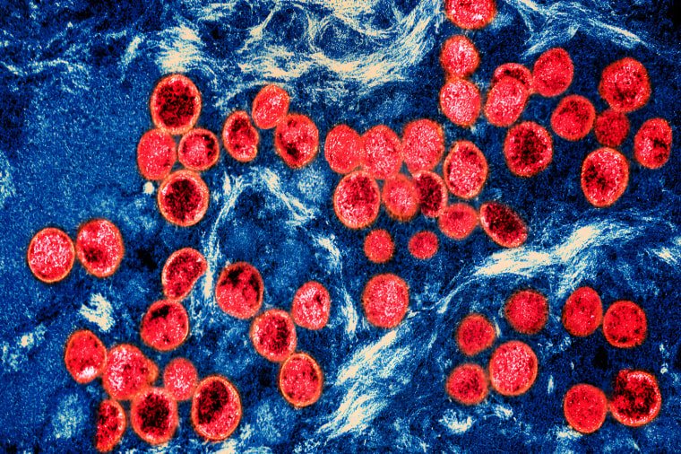 Colorized transmission electron micrograph of mpox virus particles (red) found within an infected cell (blue), cultured in the laboratory. 