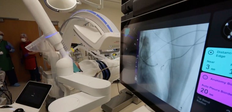 lung cancer robotic technology