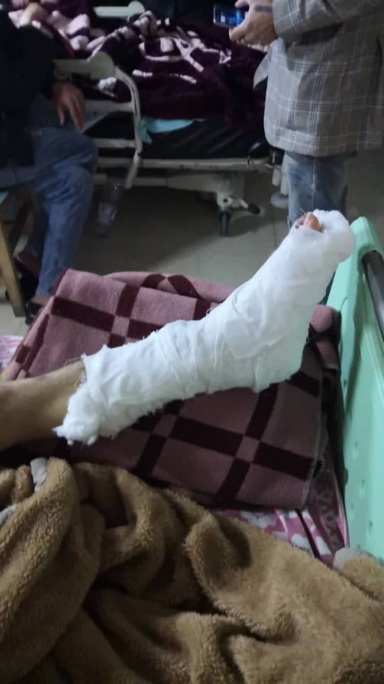 Ibrahim Zakaria's severely broken and infected leg.