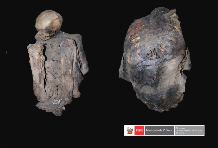 The scans revealed the condition of the mummified body, which is believed to be that of a man.